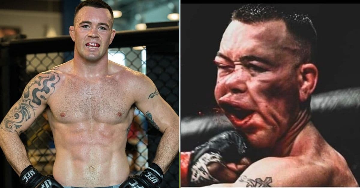WATCH: Colby Covington's Jaw Is Healing Up Faster Than Expected
