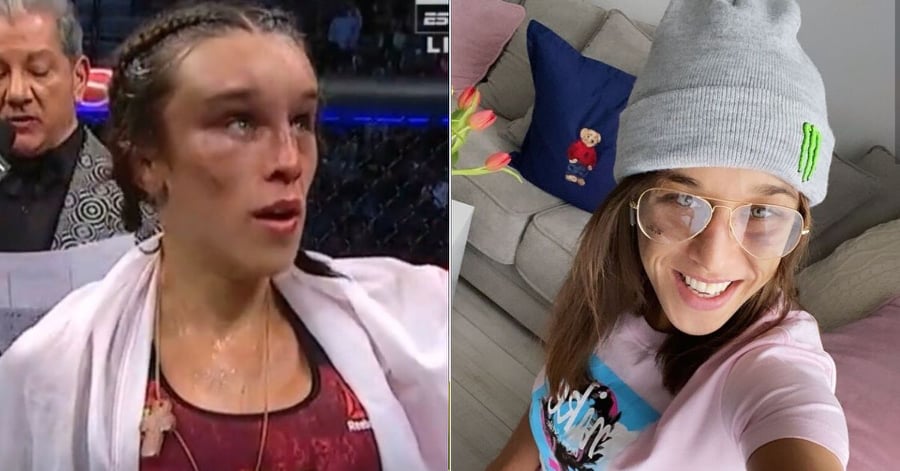Joanna Jedrzejczyk Flaunts Incredible Transformation After Horrific Facial Injuries