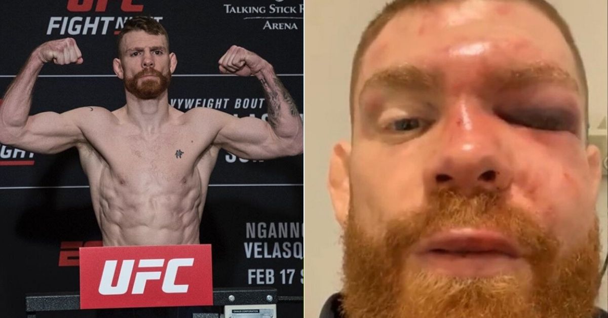 Paul Felder Shares Photos Of Injuries He Sustained In His 10-Year MMA Career