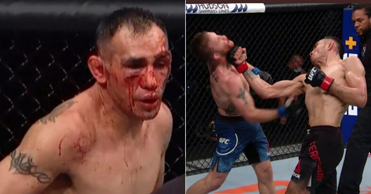 Report: Tony Ferguson Suffered Orbital Injury In Brutal Loss To Justin Gaethje